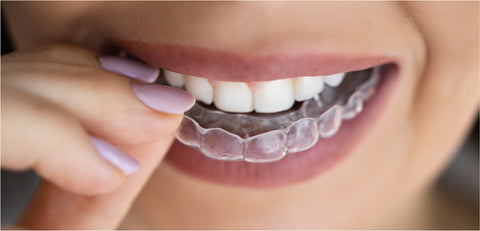 Gouttière Bruxisme : Le guide complet pour soulager le grincement des dents